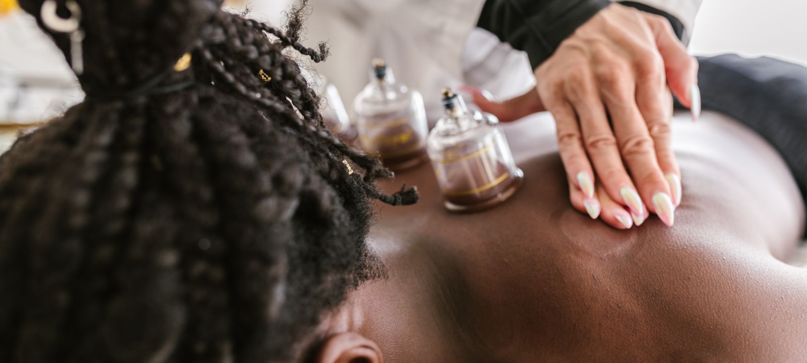 Cupping Therapy 1 Cupping Therapy at The Spine and Wellness Center in Coral Springs, FL